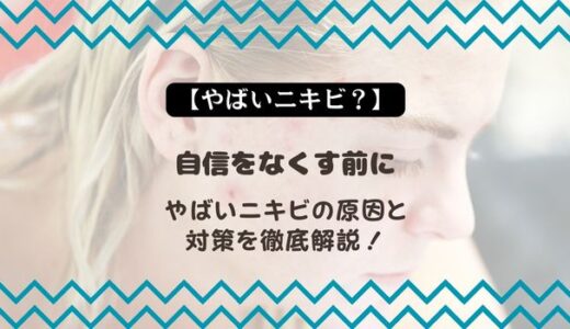 【やばいニキビ？】自信をなくす前にやばいニキビの原因と対策を徹底解説！